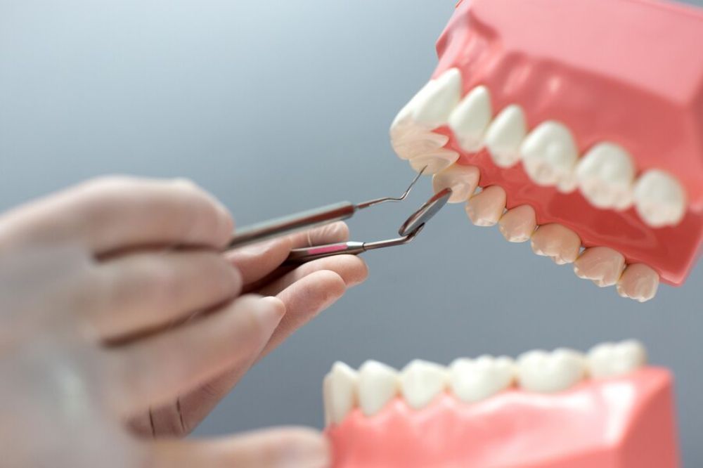 dental bridges for missing teeth improving your smile and oral health